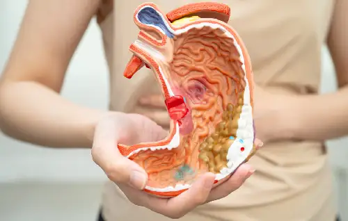 Acid Reflux / GERD, Dr Abhishek Banerjee