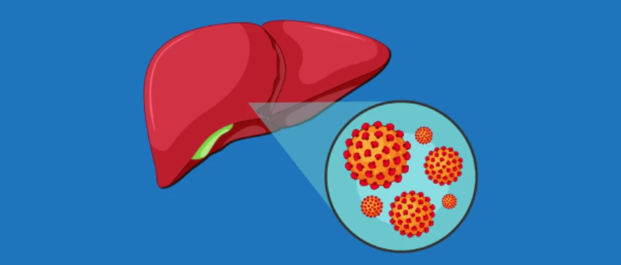 Cirrhosis Treatment in Kolkata, Dr Abhishek Banerjee