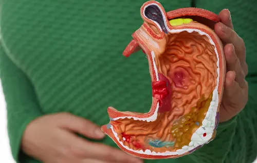 Dyspepsia, Dr Abhishek Banerjee