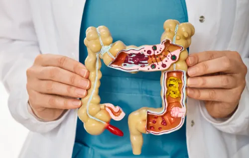 Gastrointestinal Polyps, Dr Abhishek Banerjee