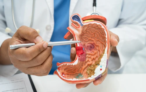 Gastrointestinal Bleeding, Dr Abhishek Banerjee