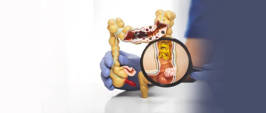 IBD Treatment in Kolkata, Dr Abhishek Banerjee