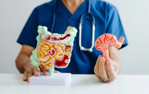 Inflammatory Bowel Disease (IBD), Dr Abhishek Banerjee